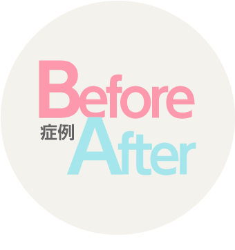症例 Before After